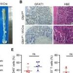 Cell Rep丨复旦大学阮元元等团队研究揭示了HBP通过使自发性结直肠癌小鼠模型中的肿瘤细胞免疫逃逸来促进致癌作用