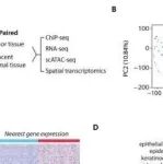 Adv Sci丨中国医学科学院李文斌等团队研究发现肺鳞癌通过增强子重编程激活MDK-PTPRZ1通路的肿瘤发生机制