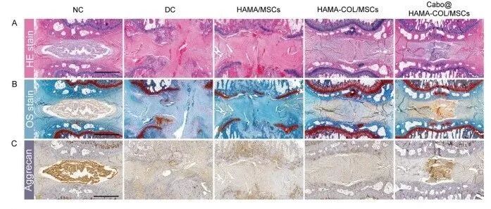 如何利用HAMA-COL双网络水凝胶用于退变髓核修复？