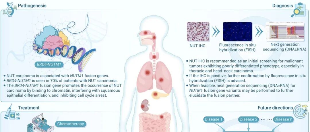 The Innovation | NUT癌国际诊疗指南