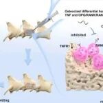 Bioact Mater丨武汉理工大学戴红莲等团队研究发现双药预混磷酸三镁骨水泥可调节骨稳态治疗骨质疏松性椎体压缩性骨折