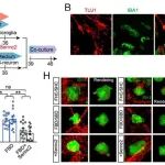 PNAS | 清华大学姚骏等团队研究发现小胶质细胞通过Serinc2依赖性磷脂合成促进双相抑郁症