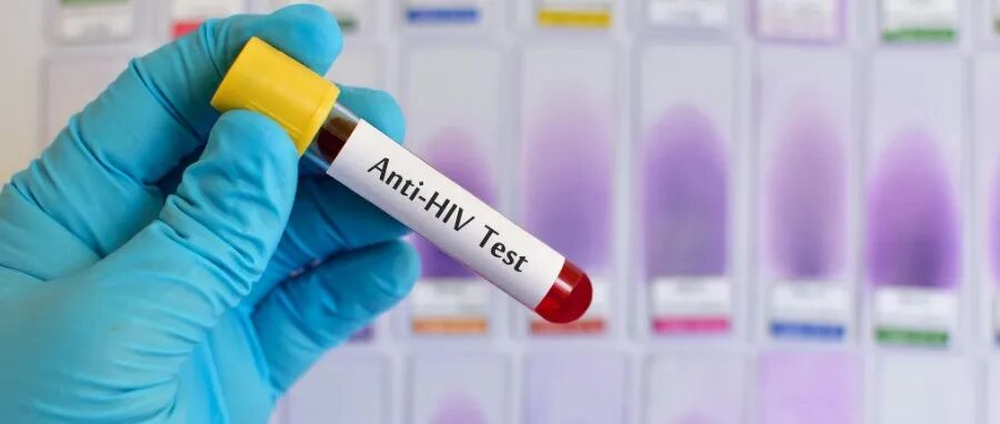 研究表明，女性或比男性更能有效地抑制HIV病毒库｜Science Translational Medicine