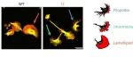 Science Advances | 成人小胶质细胞细胞骨架调控可恢复神经发育性突触与认知缺陷