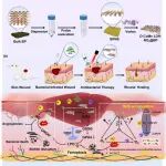 Nano Lett：激光-超声响应型纳米反应器可重塑抗生素耐药性细菌感染的微环境以促进糖尿病伤口愈合