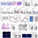 Cell Mol Immun | 中山大学张辉杨念生团队研究揭示巨噬细胞来源的VISTA在肠炎发病机制中的作用与机制