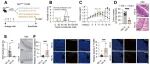 Cancer Res | 中山大学何晓生等团队研究发现约氏乳杆菌合成鹅去氧胆酸降低高脂肪饮食诱导的结直肠癌易感性