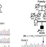 Adv Sci丨中山大学张清炯等人研究发现TRIM49是ULK1介导的RPE自噬和POS吞噬作用的关键调控因子
