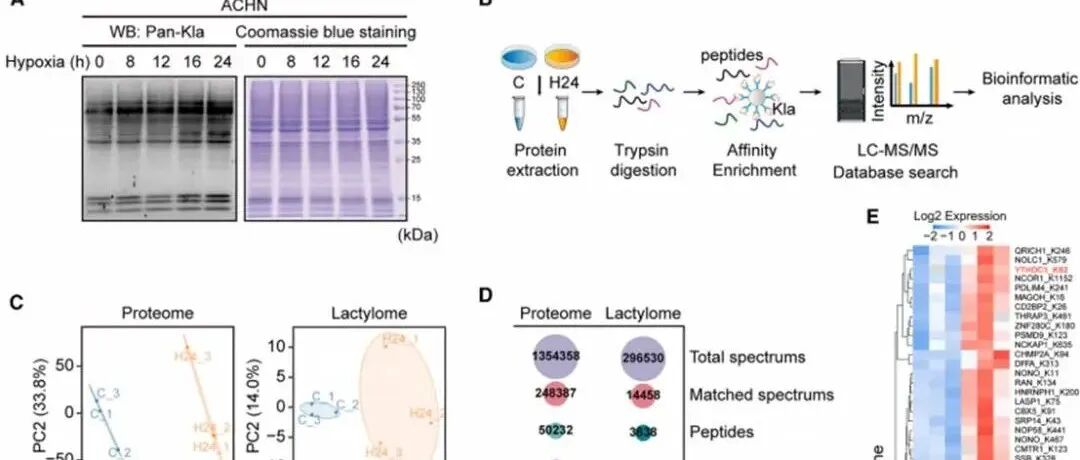 Mol Cell | 首都医科大学郑君芳揭示YTHDC1乳酰化调节其相分离以增强靶标mRNA稳定性并促进肾癌进展
