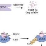 Cell Death Differ | 青岛大学马蕾娜等团队研究发现SPOP突变通过TRIM24介导ULK1泛素化调控能量应激