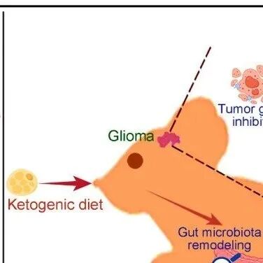 Cancer Cell丨陆军军医大学卞修武团队发现生酮饮食通过促进肠道微生物群产生丁酸盐来抑制胶质瘤进展！