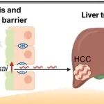 Cell Metab丨香港中文大学于君等发现新型促癌肠道细菌，通过与肝细胞结合并产生喹啉酸促进肝细胞癌变！