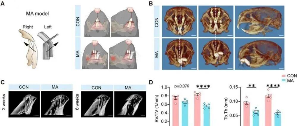 Adv Sci丨空军军医大学黄静等人研究阐明ACC依赖机制连接牙颌结构异常与慢性疼痛-情绪共病