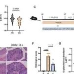 Adv Sci丨华南理工大学周有连/聂玉强研究强调了LCA的菌群依赖性调控是内脏臭杆菌的关键保护机制