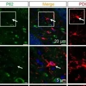 Sci Adv丨苏州大学马全红等团队研究发现少突胶质细胞前体细胞巨自噬受损会通过衰老相关信号抑制神经元可塑性
