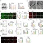 JEV丨中国医科大学白涛等研究发现BRAF突变可通过CRISPR/Cas9递送逆转维莫非尼耐药性