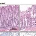 Cell Death Differ丨武汉大学叶梅发现上皮MST1缺乏可通过YAP/p73信号通路促进细胞焦亡并加重炎症性肠病