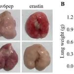 Cancer Res丨贵州医科大学陈腾祥/金帮明研究发现MEN1通过破坏CD44选择性剪接促进铁下垂抑制肺癌