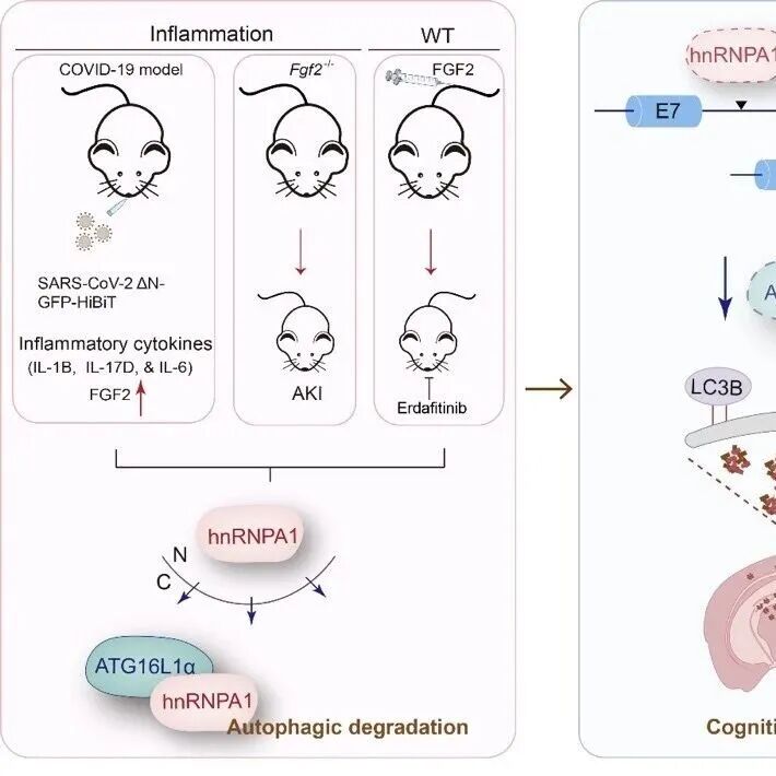 Autophagy | 武汉大学周荣家教授课题组揭示炎症信号削弱剪接体功能和认知能力的新机制