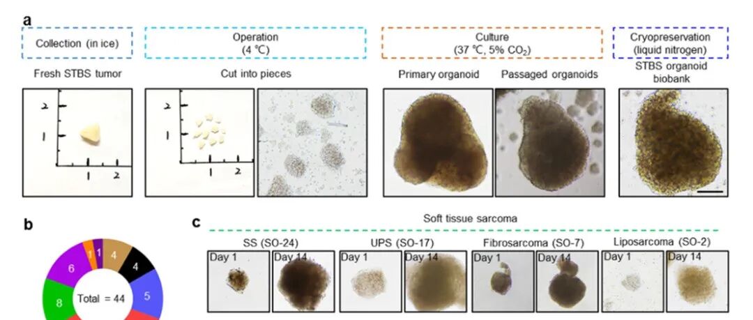 Biomaterials | 中国医学科学院肿瘤医院冯和林团队基于患者来源肉瘤类器官的个性化药物筛选和精准癌症免疫治疗