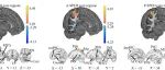 PNAS | 电子科技大学生命学院neuSCAN团队赵伟华副研究员发表最新研究成果