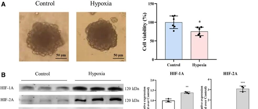 Hypertension | 华东师范大学王昕等构建类器官模型阐明阿司匹林预防先兆子痫的机制
