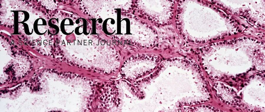 Research综述|神经内分泌前列腺癌分子治疗靶点
