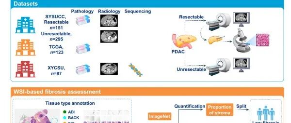 Mol Cancer | 中南大学龚学军、李宜雄教授团队在胰腺癌诊治领域发表系列高水平研究