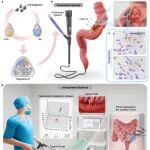 华科大蔡开琳、李亮、欧阳君等《Bioact. Mater.》：增强可注射水凝胶剩磁实现软组织腔内肿瘤的电磁跨壁定位