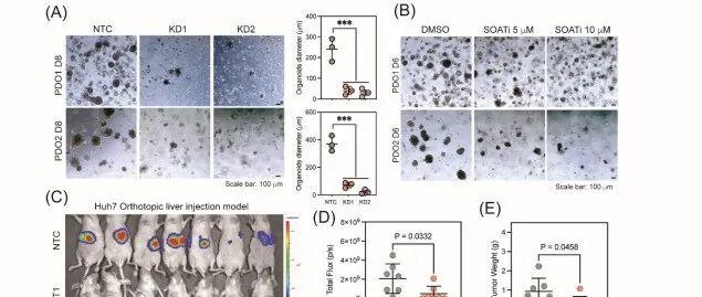 Hepatology | 香港大学吴吕爱莲团队揭示抑制SOAT1重塑肝癌脂代谢并提升免疫疗效