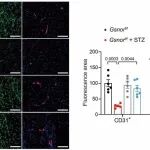 Science子刊丨南京医科大学谢利平等研究发现S-亚硝基谷胱甘肽还原酶可作为糖尿病血管并发症的治疗靶点