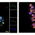 Cancer Res丨北京大学徐涛等研究发现靶向唾液酸化可增强Enfortumab Vedotin对膀胱癌的治疗效果