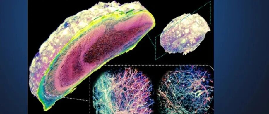 Science封面: 水凝胶·光化学切片·大体积成像·超分辨 - 高瑞轩教授、Srigokul Upadhyayula