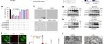 Nature chemical biology | 一种靶向LIC1的小分子通过诱导自噬抑制肺癌生长