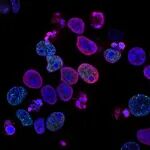 Adv Sci | 南京大学蒋青，郭保生：骨关节炎滑膜成纤维细胞外泌体激活巨噬细胞糖酵解