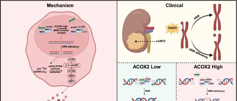 Mol Cancer | 复旦大学张海梁团队揭示肾癌中DNA修复与肿瘤免疫调控新机制