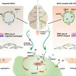 PNAS | 苏州大学放射医学与辐射防护国家重点实验室李桢团队在修复受损脑膜淋巴管治疗帕金森病方面取得新进展