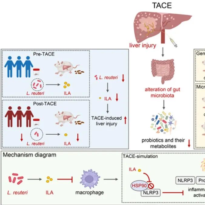 J Hepatol | 中山大学朱康顺团队发现经动脉化疗栓塞引起的微生物代谢功能障碍加重肝细胞癌术后肝损伤
