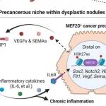 Nat Cancer丨重庆大学钱程等发现表达MEF2D的癌前体重编程组织内巨噬细胞以支持肝肿瘤的发生