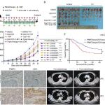 Cancer Res | 哈尔滨医科大学尹航/王校媛发现非小细胞肺癌放射抗性的潜在新机理