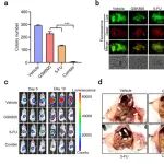 Cancer Res | 中山大学王军舰等团队合作发现RORγ劫持HIF-1α促进胃癌腹膜转移