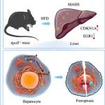 Free Radical Biol Med | 南华大学姜志胜发现CDKN1A和EGR1是MASH中促内质网应激致铁死亡的关键