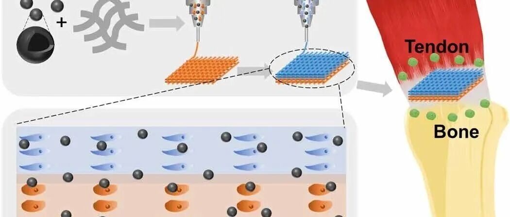 《Science Advances》：如何利用基于硅酸锰纳米颗粒的多细胞水凝胶支架实现肌腱-骨一体化再生？