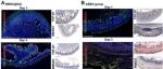 Adv Sci | 福建医科大学陈先强等发现骨髓间充质干细胞水凝胶介导的成纤维细胞重编程可恢复粘连性小肠梗阻的肠道功能