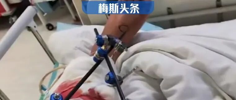 热议！患者自查耗材价格，医院竟比网上贵十几倍！医院：购买方式不对导致价格差！江苏省医保局介入调查！刷医保比自费更贵，国家出手了