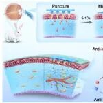 ACS Nano：溶解性双层微针可实现高效的角膜基质内双药递送以协同治疗角膜新生血管