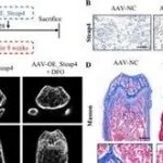 Adv Sci | 南京医科大学王禹基等团队合作发现Steap4 促进老年性骨质疏松症的潜在机理