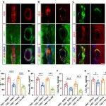 Sci Adv | 中国药科大学司马健发现DKK3-LRP1复合物和一种化学抑制剂调控阿尔茨海默病模型中Aβ的清除