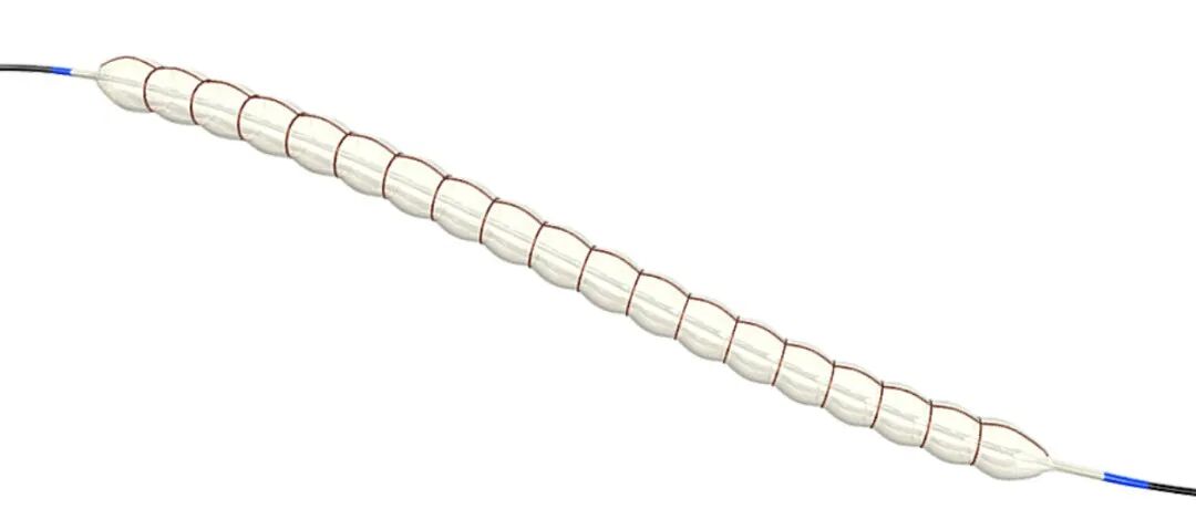 JVIR | 能挽救股腘动脉 PTA后夹层的不止支架，还有“巧克力”