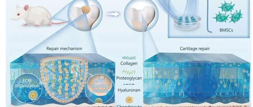 上海大学苏佳灿团队：基于DNA-SF水凝胶缓释系统的软骨有机化合物促进软骨再生